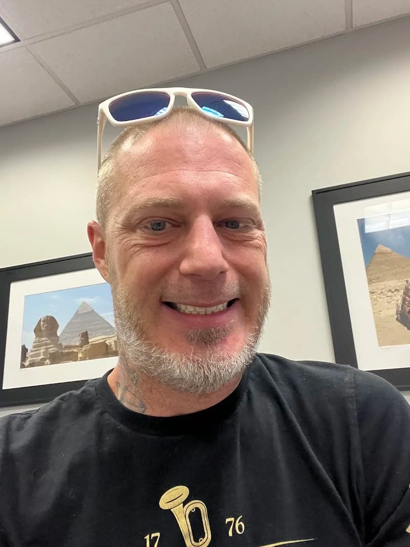 Single & Multiple Dental Implants patient after treatment