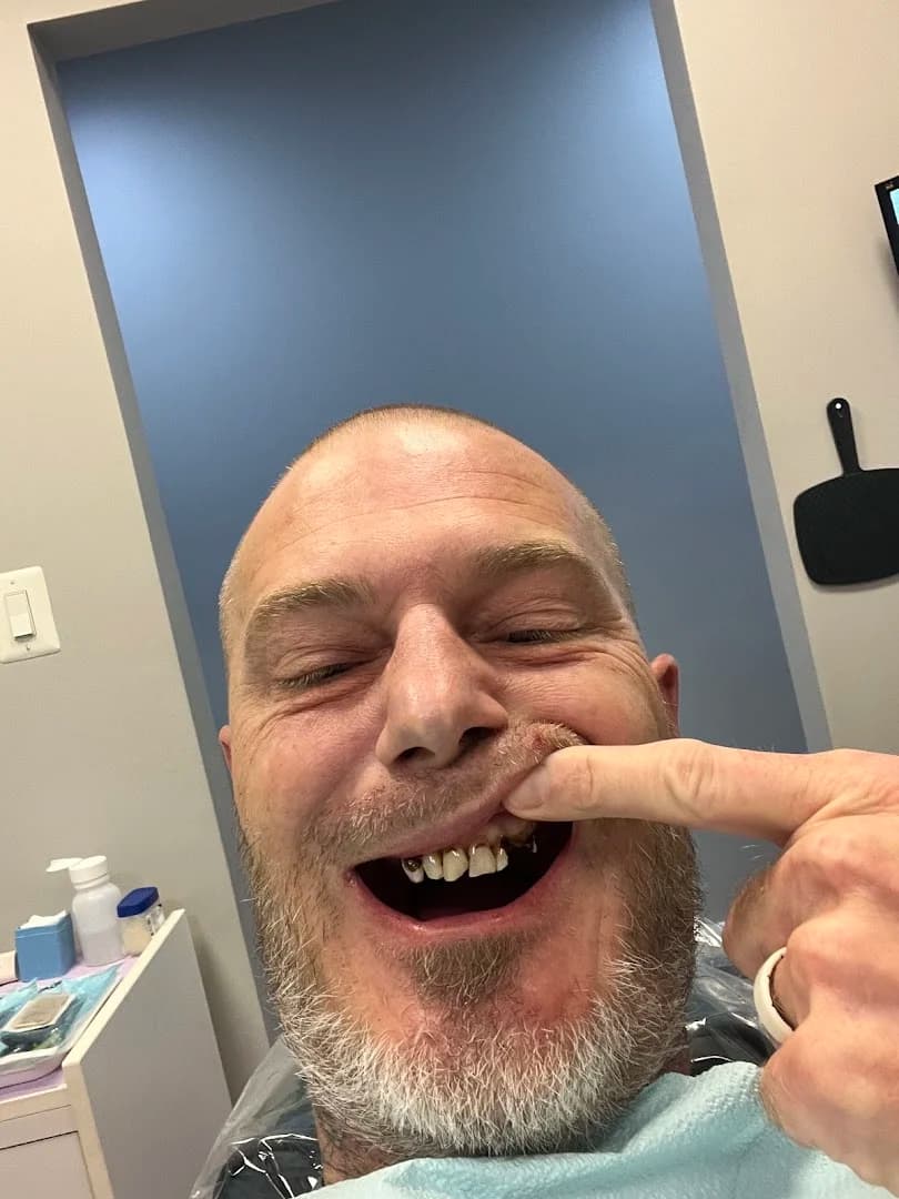 Single & Multiple Dental Implants patient before treatment
