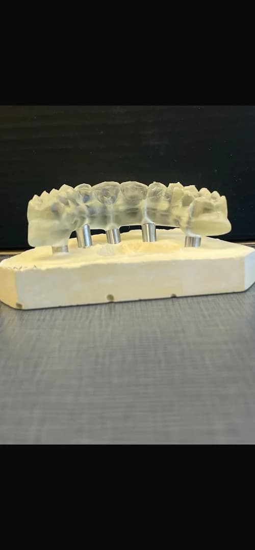 A dental implant model and surgical guide