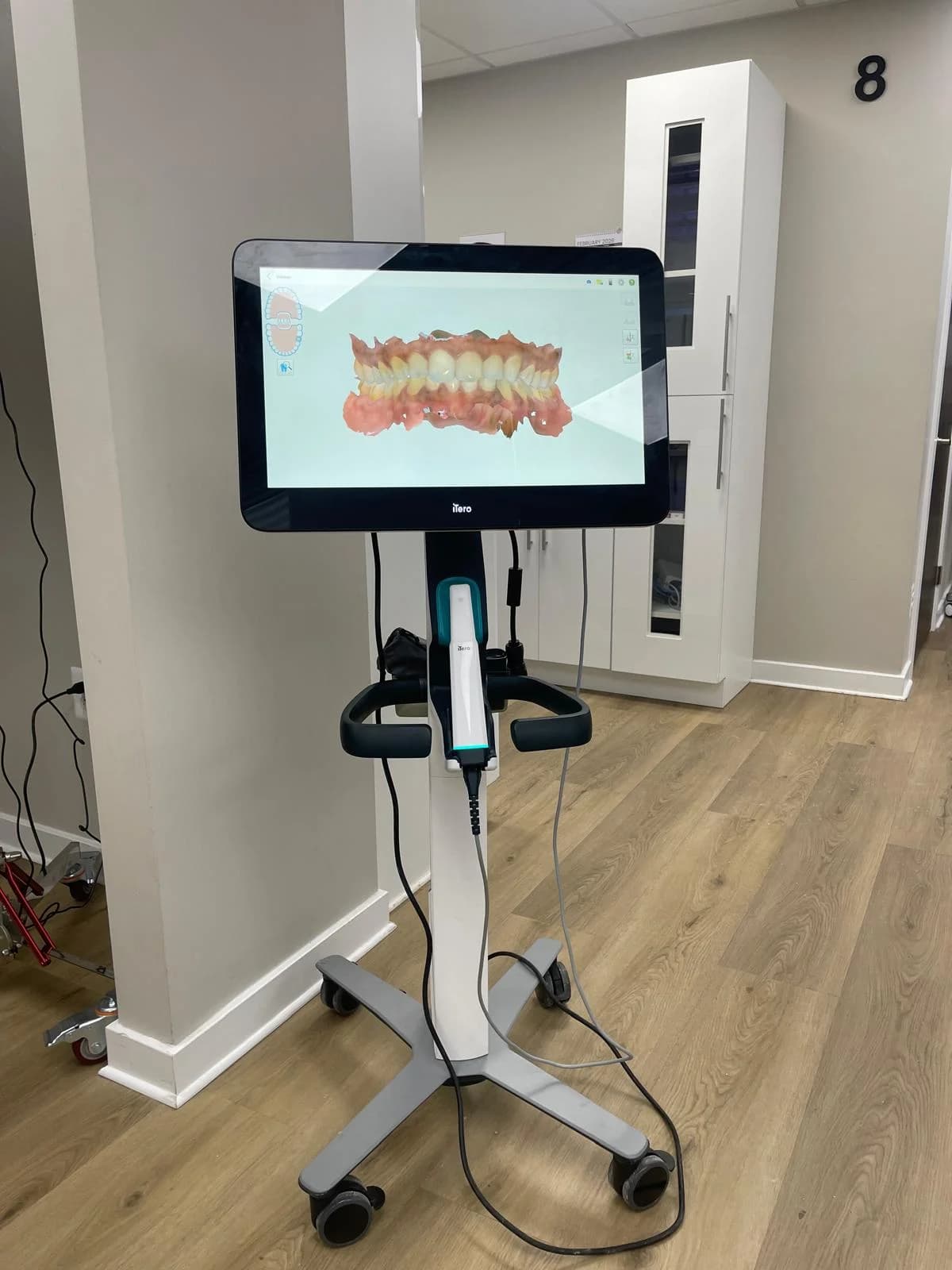 The in-office scanner displaying a 3D digital scan of teeth on screen