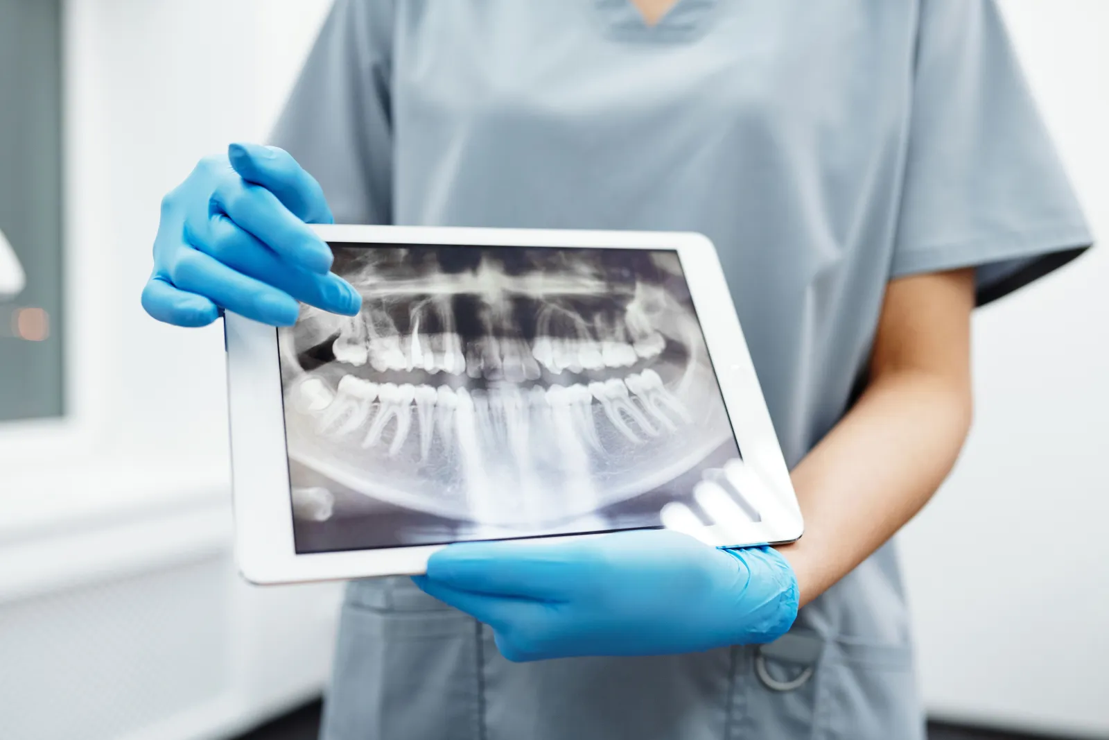 Root Canal or Pull the Tooth? What Each Choice Costs You Later